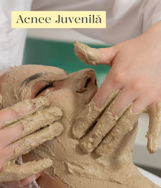 Tratament Cosmetic 100% Natural pentru Acnee Juvenilă (9-14 ani)